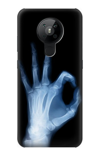 S3239 X線手札OK X-Ray Hand Sign OK Nokia 5.3 バックケース、フリップケース・カバー