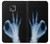 S3239 X線手札OK X-Ray Hand Sign OK Motorola Moto G Power (2021) バックケース、フリップケース・カバー