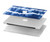 S3671 ブルータイダイ Blue Tie Dye MacBook Air 13″ - A1369, A1466 ケース・カバー