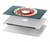 S1968 ロータリーダイヤル電話 Rotary Dial Telephone MacBook Pro 13″ - A1706, A1708, A1989, A2159, A2289, A2251, A2338 ケース・カバー