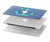 S2081 航海アンカー Nautical Anchor MacBook Pro 13″ - A1706, A1708, A1989, A2159, A2289, A2251, A2338 ケース・カバー