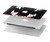 S3527 吸血鬼の歯 Vampire Teeth Bloodstain MacBook Pro 15″ - A1707, A1990 ケース・カバー