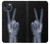 S3101 X線平和サイン手指 X-ray Peace Sign Fingers iPhone 13 mini バックケース、フリップケース・カバー