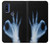 S3239 X線手札OK X-Ray Hand Sign OK Motorola G Pure バックケース、フリップケース・カバー