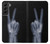S3101 X線平和サイン手指 X-ray Peace Sign Fingers Samsung Galaxy S22 Plus バックケース、フリップケース・カバー