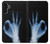 S3239 X線手札OK X-Ray Hand Sign OK Samsung Galaxy A13 4G バックケース、フリップケース・カバー