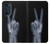 S3101 X線平和サイン手指 X-ray Peace Sign Fingers Motorola Edge 30 Pro バックケース、フリップケース・カバー