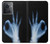 S3239 X線手札OK X-Ray Hand Sign OK OnePlus 10R バックケース、フリップケース・カバー