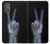 S3101 X線平和サイン手指 X-ray Peace Sign Fingers Motorola Moto G Power 2022, G Play 2023 バックケース、フリップケース・カバー