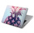 S3711 ピンクパイナップル Pink Pineapple MacBook Air 15″ (2023,2024) - A2941, A3114 ケース・カバー