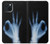 S3239 X線手札OK X-Ray Hand Sign OK iPhone 15 バックケース、フリップケース・カバー