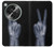 S3101 X線平和サイン手指 X-ray Peace Sign Fingers OnePlus OPEN バックケース、フリップケース・カバー