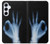 S3239 X線手札OK X-Ray Hand Sign OK Samsung Galaxy A55 5G バックケース、フリップケース・カバー