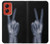 S3101 X線平和サイン手指 X-ray Peace Sign Fingers Motorola Moto G Stylus 5G (2024) バックケース、フリップケース・カバー
