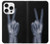 S3101 X線平和サイン手指 X-ray Peace Sign Fingers iPhone 16 pro バックケース、フリップケース・カバー