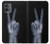 S3101 X線平和サイン手指 X-ray Peace Sign Fingers Motorola Moto G14 バックケース、フリップケース・カバー