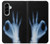 S3239 X線手札OK X-Ray Hand Sign OK Samsung Galaxy A56 バックケース、フリップケース・カバー