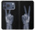 S3101 X線平和サイン手指 X-ray Peace Sign Fingers iPhone 17 Pro, 18 Pro バックケース、フリップケース・カバー