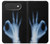 S3239 X線手札OK X-Ray Hand Sign OK iPhone Air バックケース、フリップケース・カバー