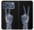 S3101 X線平和サイン手指 X-ray Peace Sign Fingers iPhone 17 Pro Max, 18 Pro Max バックケース、フリップケース・カバー