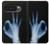 S3239 X線手札OK X-Ray Hand Sign OK Google Pixel 10 Pro XL バックケース、フリップケース・カバー