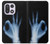 S3239 X線手札OK X-Ray Hand Sign OK OnePlus 15 バックケース、フリップケース・カバー