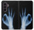 S3239 X線手札OK X-Ray Hand Sign OK Samsung Galaxy Z Fold 8 Ultra バックケース、フリップケース・カバー