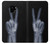 S3101 X線平和サイン手指 X-ray Peace Sign Fingers Samsung Galaxy S9 バックケース、フリップケース・カバー
