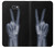 S3101 X線平和サイン手指 X-ray Peace Sign Fingers Samsung Galaxy J7 Prime (SM-G610F) バックケース、フリップケース・カバー