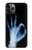 S3239 X線手札OK X-Ray Hand Sign OK iPhone 11 Pro バックケース、フリップケース・カバー