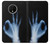 S3239 X線手札OK X-Ray Hand Sign OK OnePlus 7T バックケース、フリップケース・カバー