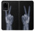 S3101 X線平和サイン手指 X-ray Peace Sign Fingers Samsung Galaxy S20 Plus, Galaxy S20+ バックケース、フリップケース・カバー