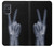 S3101 X線平和サイン手指 X-ray Peace Sign Fingers Samsung Galaxy A71 5G バックケース、フリップケース・カバー