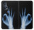 S3239 X線手札OK X-Ray Hand Sign OK Motorola Edge+ バックケース、フリップケース・カバー