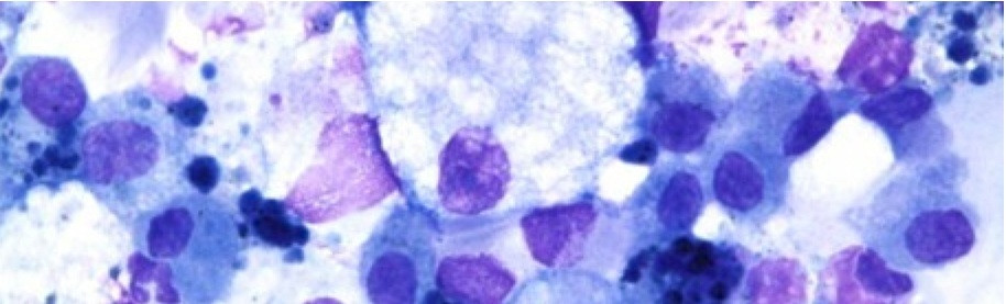 NSTEAD of NSAID: 10 Inflammation Fighting Supplements