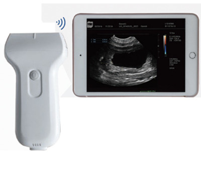 Wireless linear ultrasound scanner for human medicine