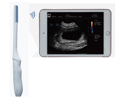 FreeSono FV-C3 Wireless Convex Probe