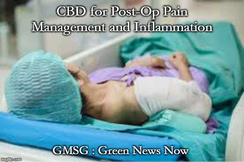 ​Green News Now : CBD, Light Therapy and Surgery