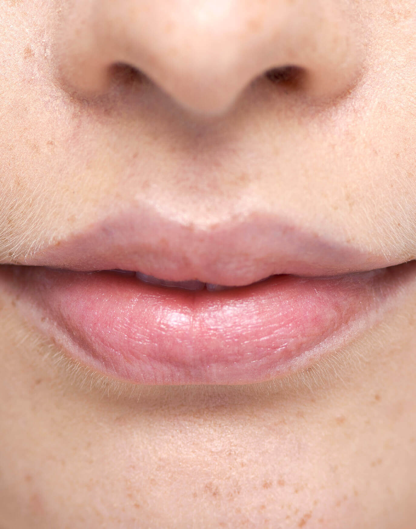 PRO Q10 + CERAMIDE