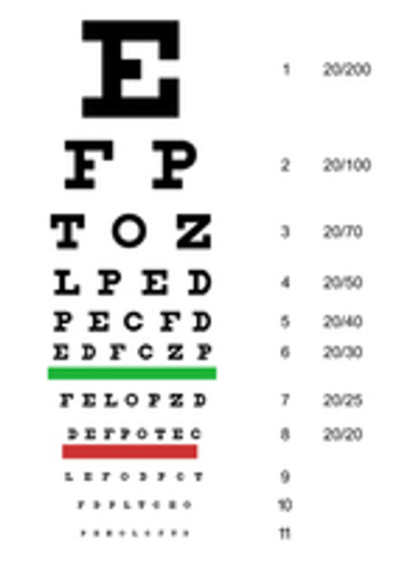 Kindergarten Snellen 20' Eye Chart