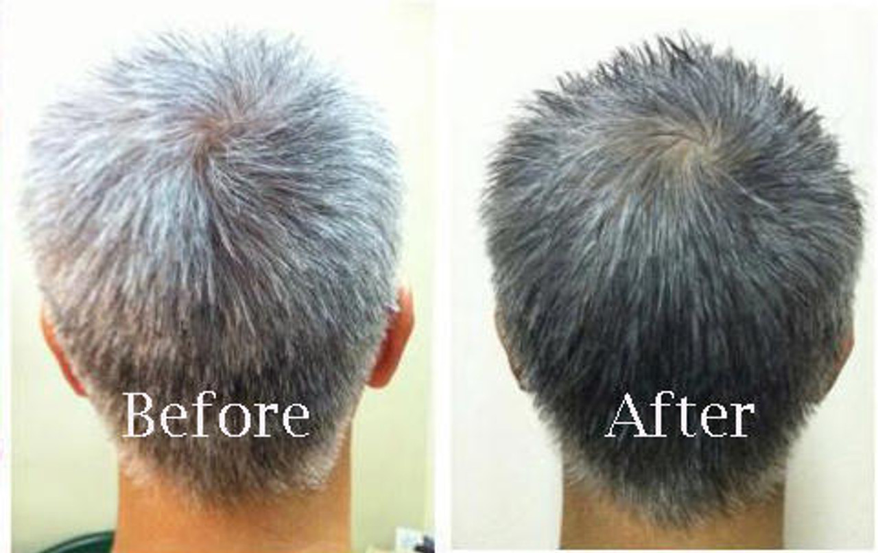 Reverse Grey Hair And Aging With The Farm Approved Daily Habit