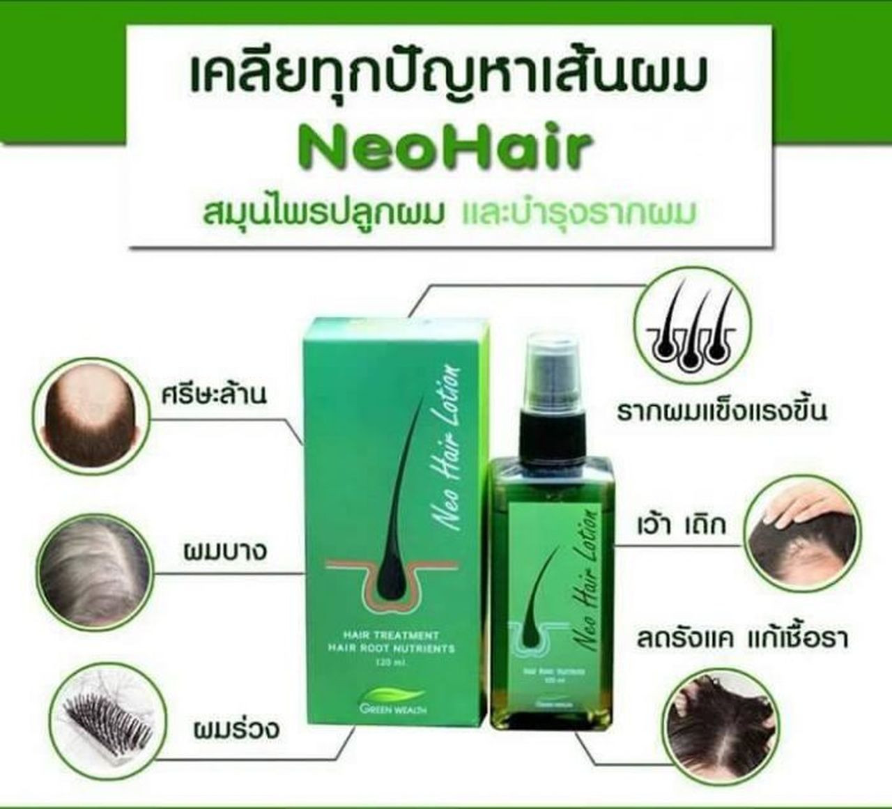 Neo hair lotion 8 Pcs , 100 Authentic 120ml worldwide delivery