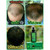 neo hair lotion review, neo hair lotion price, neo hair lotion how to use, neo hair lotion results, neo hair lotion benefits, neo hair lotion side effects, neo hair lotion reviews, neo hair lotion review, neo hair lotion english, neo hair serum pantip, worldwide delivery neo hair lotion made in Thailand , best hair regrowth neo hair lotion review, neo hair lotion price, neo hair lotion how to use, neo hair lotion results, neo hair lotion benefits, neo hair lotion side effects, neo hair lotion reviews, neo hair lotion review, neo hair lotion english, neo hair serum pantip, worldwide delivery neo hair lotion made in Thailand , best hair regrowth