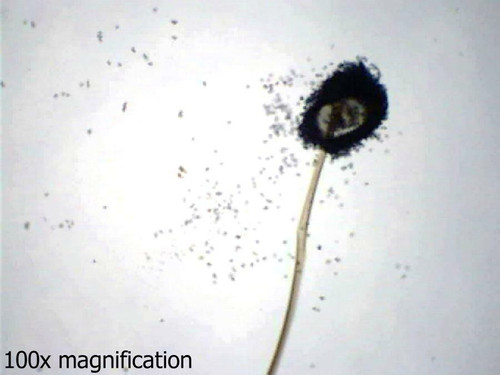 Rhizopus nigricans (Bread mold) slide, w.m.