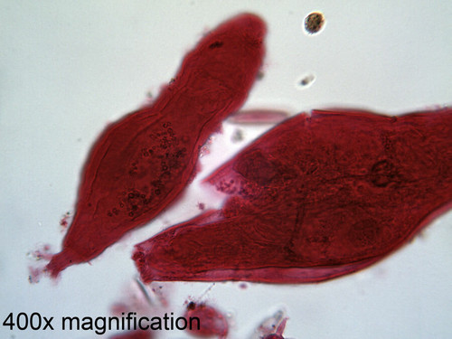 Rotifers slide, w.m.