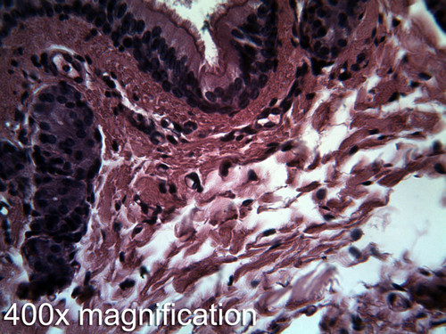 Cartilage, hyaline, sec.