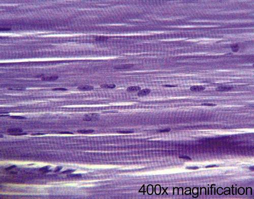 Human muscle slide, striated, l.s.
