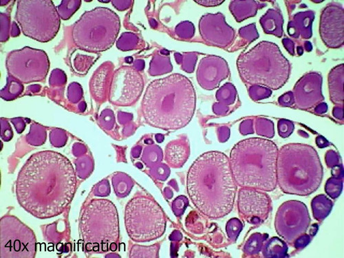 Frog ovary slide, c.s.