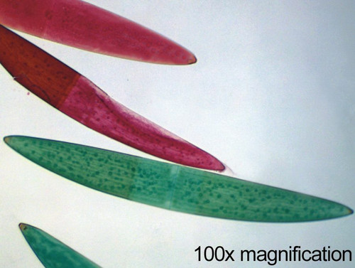 Desmids (green algae) slide, w.m.