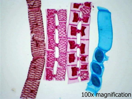 Spirogyra (green algae) slide, w.m.